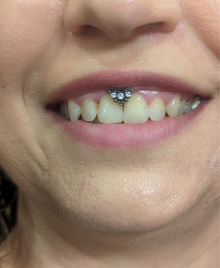 Lippenbändchen59_edited (1)